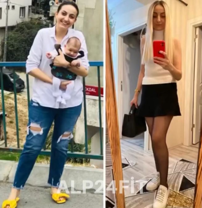 Danışan 4